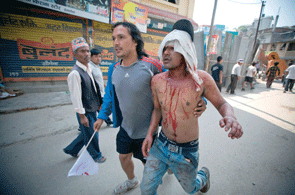 Injured demonstrator in Kathmandu, courtesy of Gulf Times, Qatar